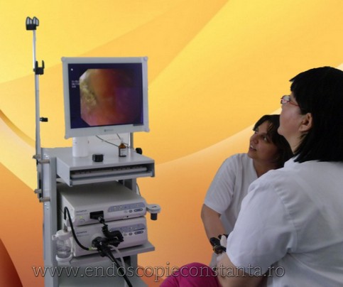 Endoscopie Constanta