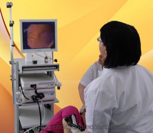 Endoscopie Constanta